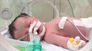 In late July 2014 Gazan doctors saved the life of little Shaima, an unborn child, by extracting her from the womb of her mother who was killed in an Israeli airstrike. Two days later, the Israeli Air Force destroyed the sole existing power plant in Gaza, thus stopping Shaima’s life support system and eventually killing the baby too.